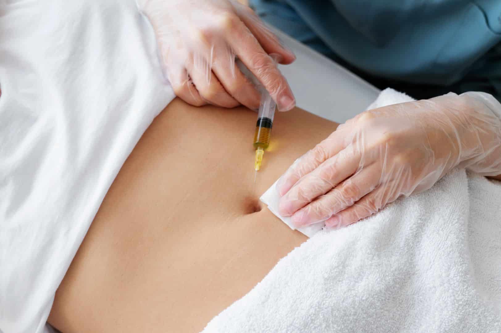 Tratamiento de Mesoterapia en CAPILART